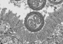 CICLOSPORIASIS: DESCUBRE SUS CAUSAS Y MECANISMOS DE TRANSMISIÓN